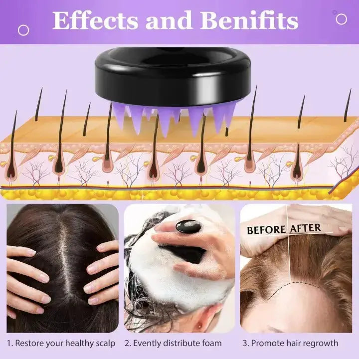 1 Piece Scalp Massager Shampoo Brush – Silicone Hair Scalp Scrubber for Deep Cleaning & Relaxing Massage (Multicolor, Pack of 1) BuyMarto
