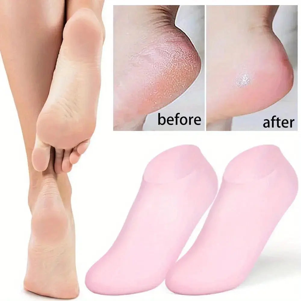 High Quality Silicone Foot Care Socks – Anti-Cracking Moisturizing Gel Socks 62gram (1 Pair) BuyMarto