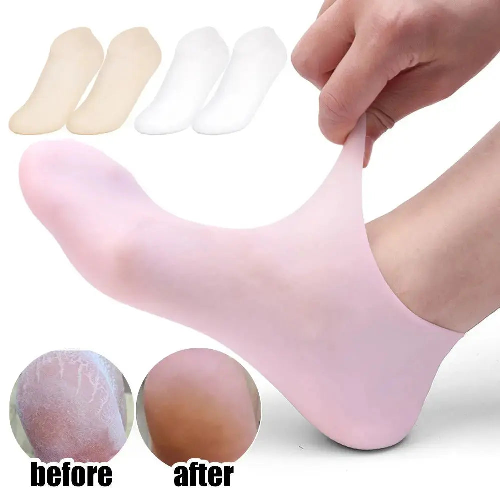 High Quality Silicone Foot Care Socks – Anti-Cracking Moisturizing Gel Socks 62gram (1 Pair) BuyMarto